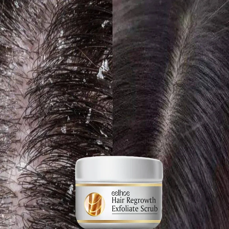 Tratamiento Capilar Anticaspa  - Hair Care Dandruff reseña y precio